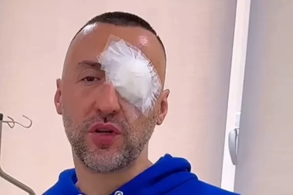 Ca mr*kullie! Ja si i duket syri G-Banit pasi bëri ndërhyrjen e shumëpritur (Foto)