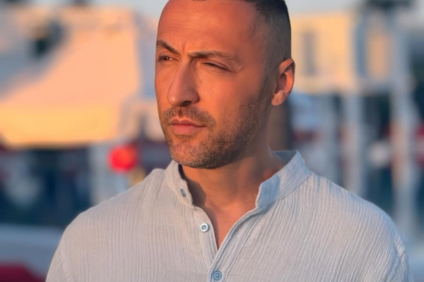 E papritur/ Pas syrit, G-Bani bën një tjetër ndërhyrje në fytyrë, nuk njihet me (FOTO)