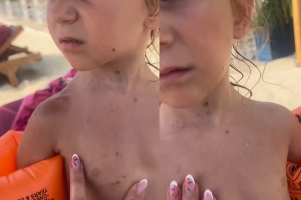 Agron Shehaj tr*ndit: E rende në Durrës: Vajza 4-vjeçare del nga deti “e mbuluar” nga nafta, cfare ndodhi (Video)