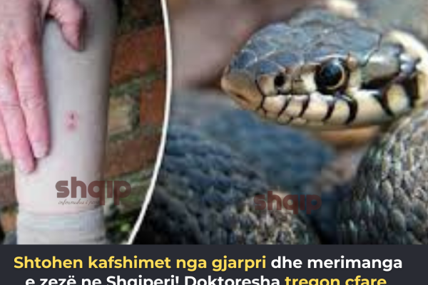 Shtohen k*fshimet nga gjarpri dhe merimanga e zezë ne Shqiperi! Doktoresha tregon cfare te beni per te shpetuar jeten